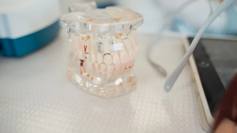 dental implant model closeup