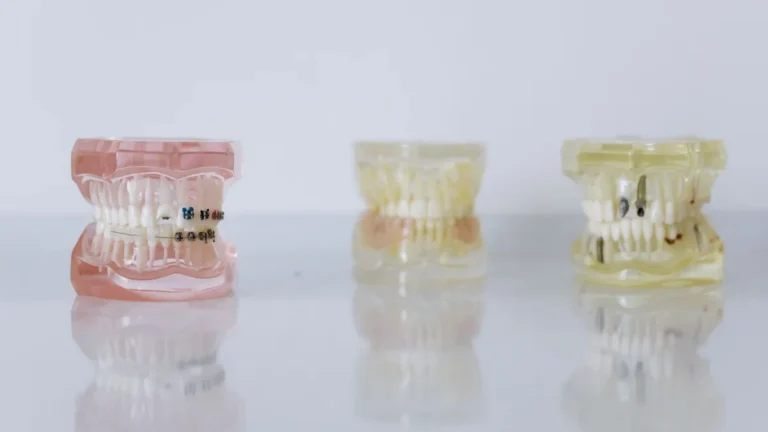 dental implant model closeup