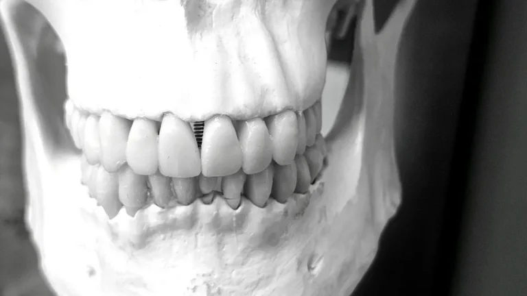 dental implant model closeup