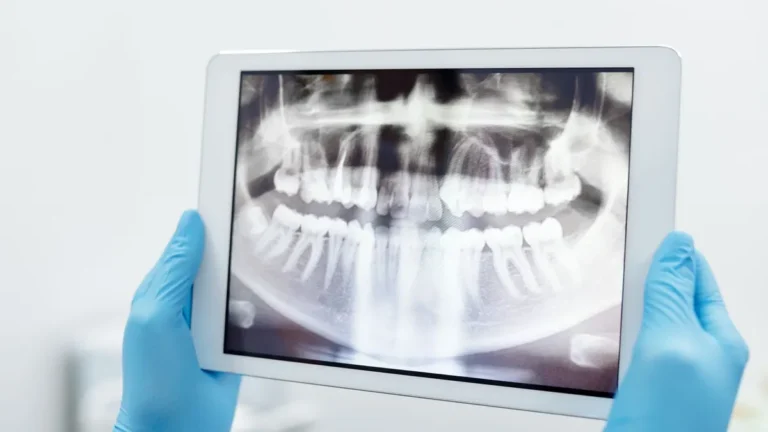 dental x-ray panoramic scan